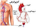 دانلود پاورپوینت درباره آنژیوگرافی و معرفی دستگاهه